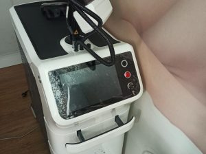 Se vende láser Dermablate MCL31